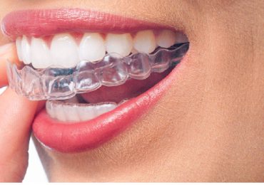 invisalign-de-confianza-en-vic