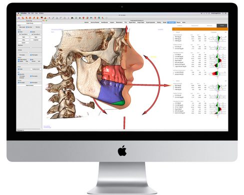 Proceso implantologia Coadental