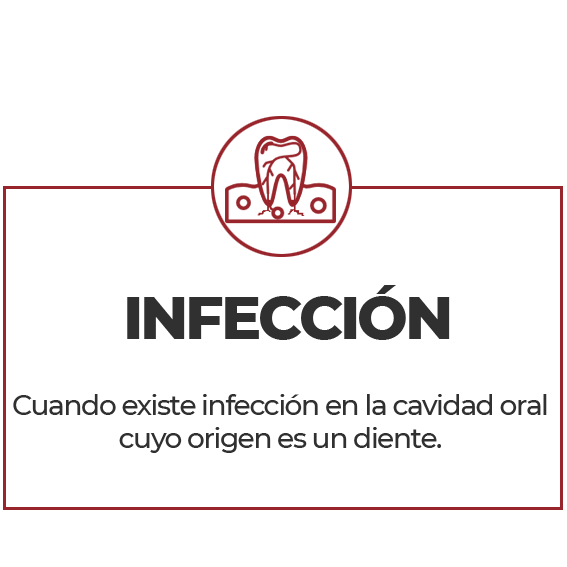 Infeccion dental
