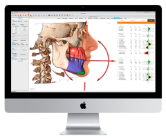 Cefalometrias_Estudio_Dental Cefalometrias_Estudio_Dental